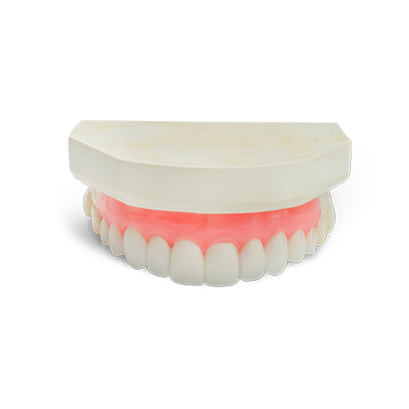 Diagnostic-WaxUp