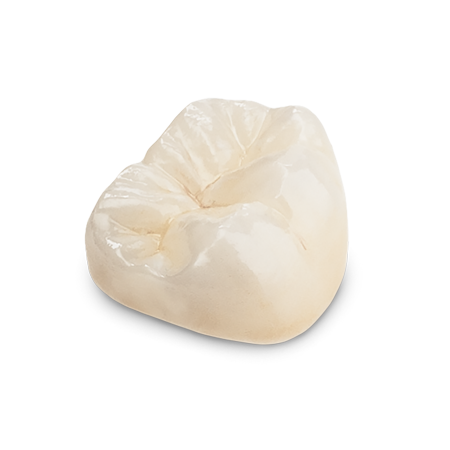 Diagnostic-WaxUp