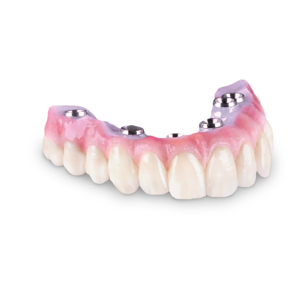 Diagnostic-WaxUp