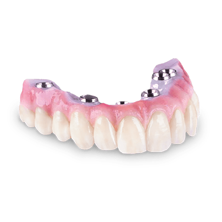 All-On-4® Restorations